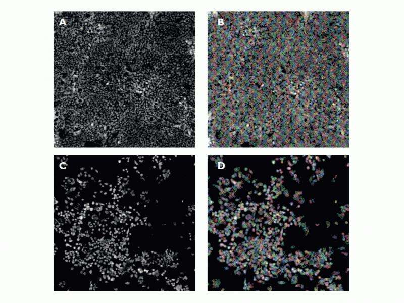 When High Content Screening Meets High Throughput - Drug Discovery ...
