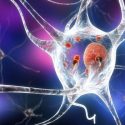 Parkinson's disease