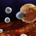 T cells attack a cancer cell