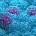 Pancreatic cancer