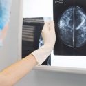 Medical professional examining mammogram