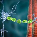 Demyelination of neuron