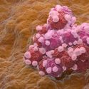 Ovarian cancer cells