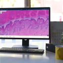 Pathology data for HIV