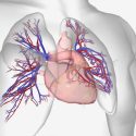 Pulmonary hypertension