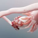 Ovarian cancer
